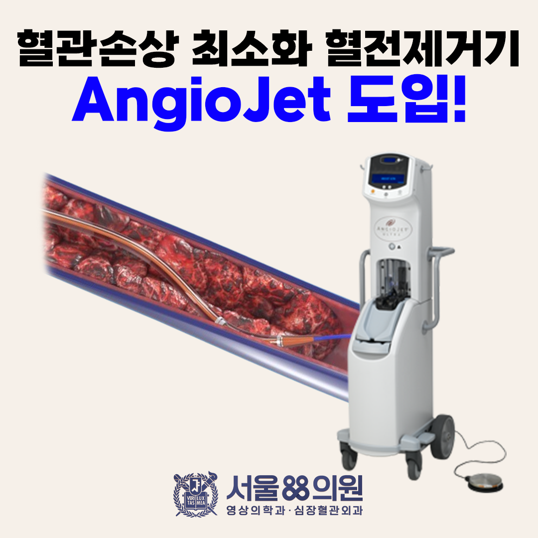 혈관손상 최소화 혈전제거기 AngioJet 도입! (서울88의원)