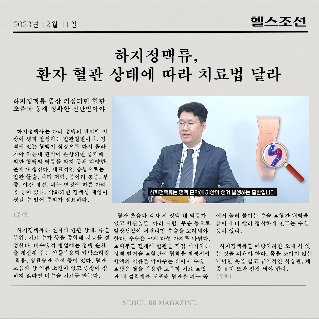 [헬스조선 기사] 하지정맥류, 환자 혈관 상태에 따라 치료법 달라